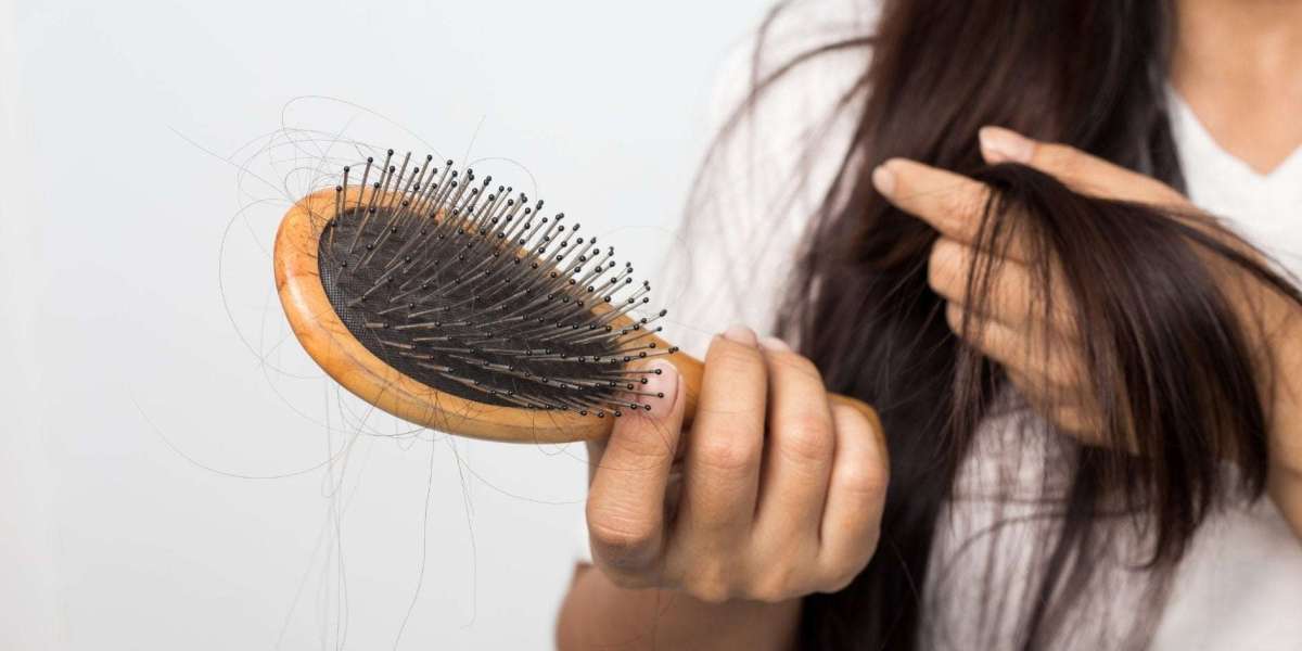 علاج تساقط الشعر في دبي: ما تحتاج إلى معرفته