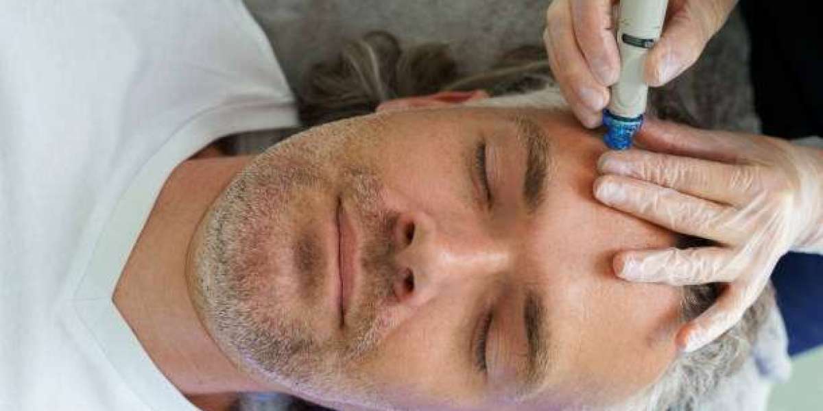 Hydrafacial Therapy: Enhancing Men's Skincare Routine