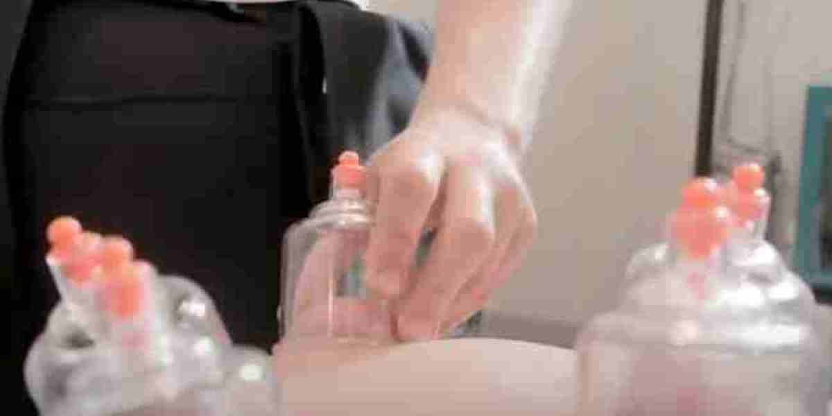 Benefits of Cupping Massage: Enhancing Well-being Naturally