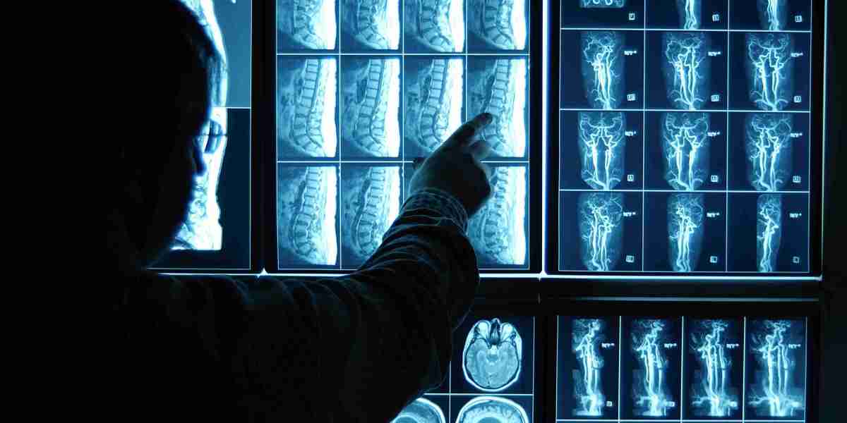 Neuroradiologists Leveraging Cutting-Edge Medical Imaging Techniques – What’s the Outlook of Radiology in 2024?