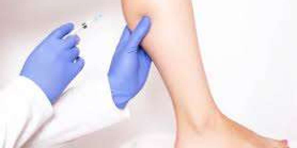 Shaping Elegance: The Art of Calf Reduction Surgery in Dubai