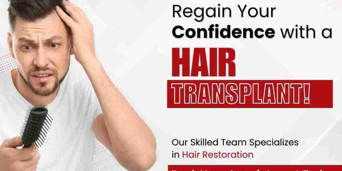 How To Manage The Cost of Hair Transplants In Delhi?