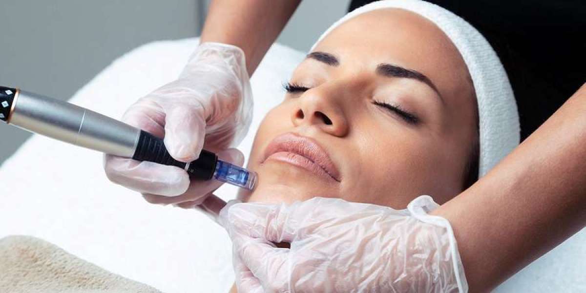 Mesotherapy Unveiled Riyadh's Best-Kept Beauty Secret