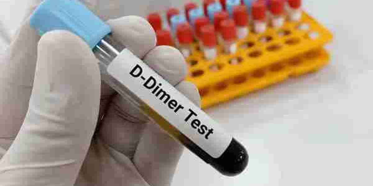 D-dimer Testing Market Share & Growth, 2024-2033