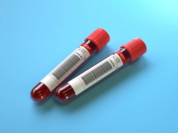 Why Should Healthcare Professionals Rely on AV Consumables Blood Collection Tubes? | by AV Consumables | Feb, 2024 | Medium
