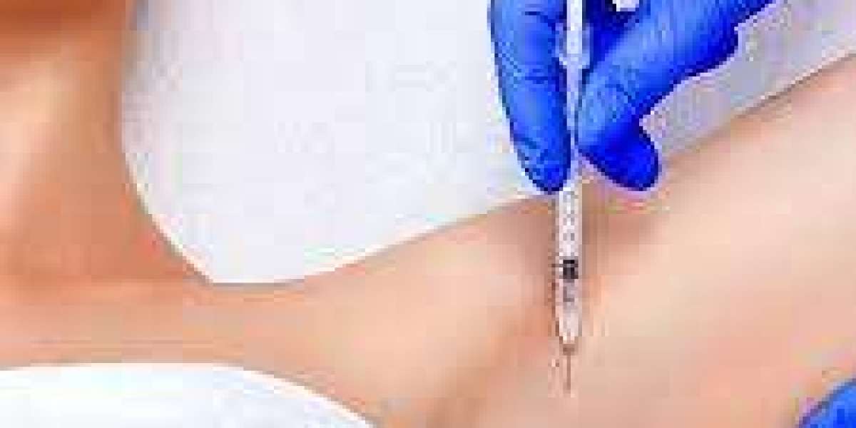 The Ultimate Guide to Botox Injection for Sweat Glands in Dubai