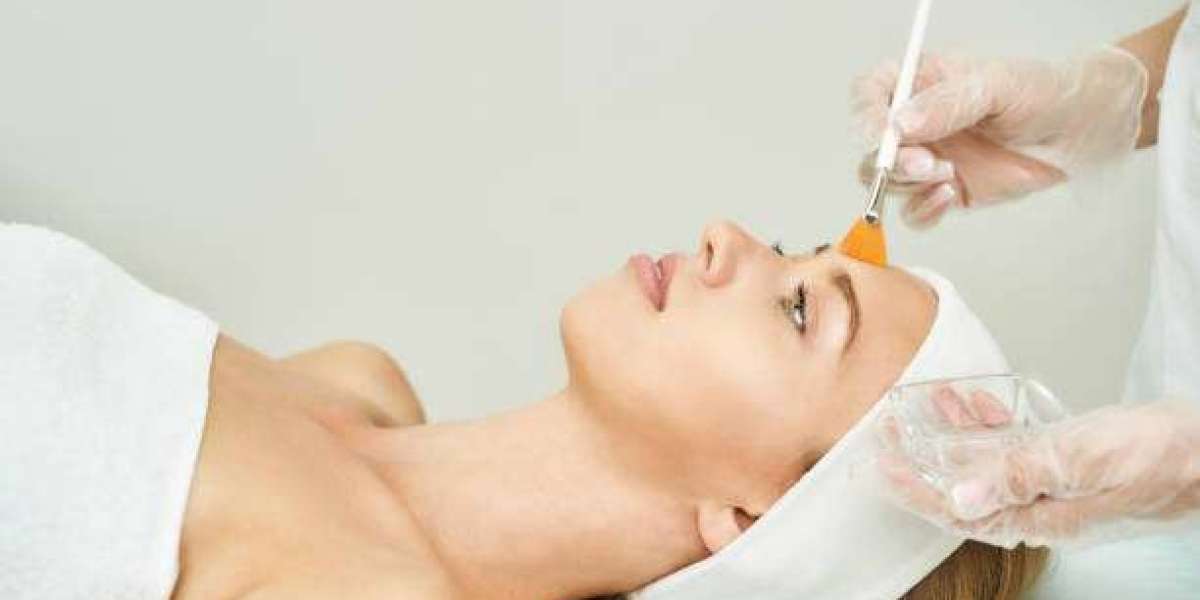 Preparing for a Chemical Peel: What to Expect