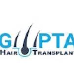 Guptahair Transplant