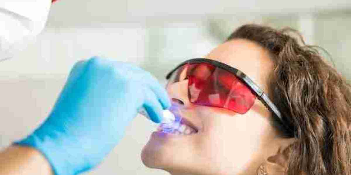 Deciphering Teeth Whitening Costs in Singapore: A Guide to Budget-Friendly Radiance