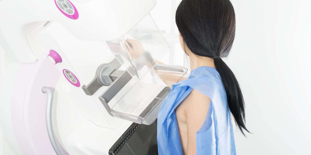 الدليل النهائي لمشهد تصوير الثدي بالأشعة السينية في دبي