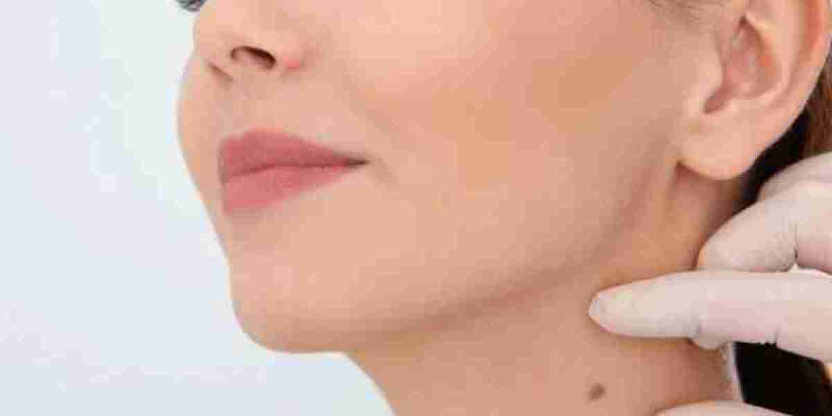 Skin lesion removal in Dubai