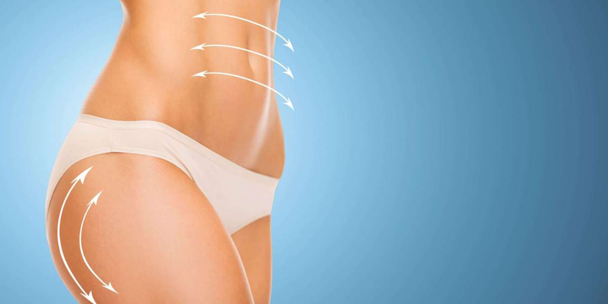 Beyond Traditional: Exploring Liposuction 360 for Complete Transformation