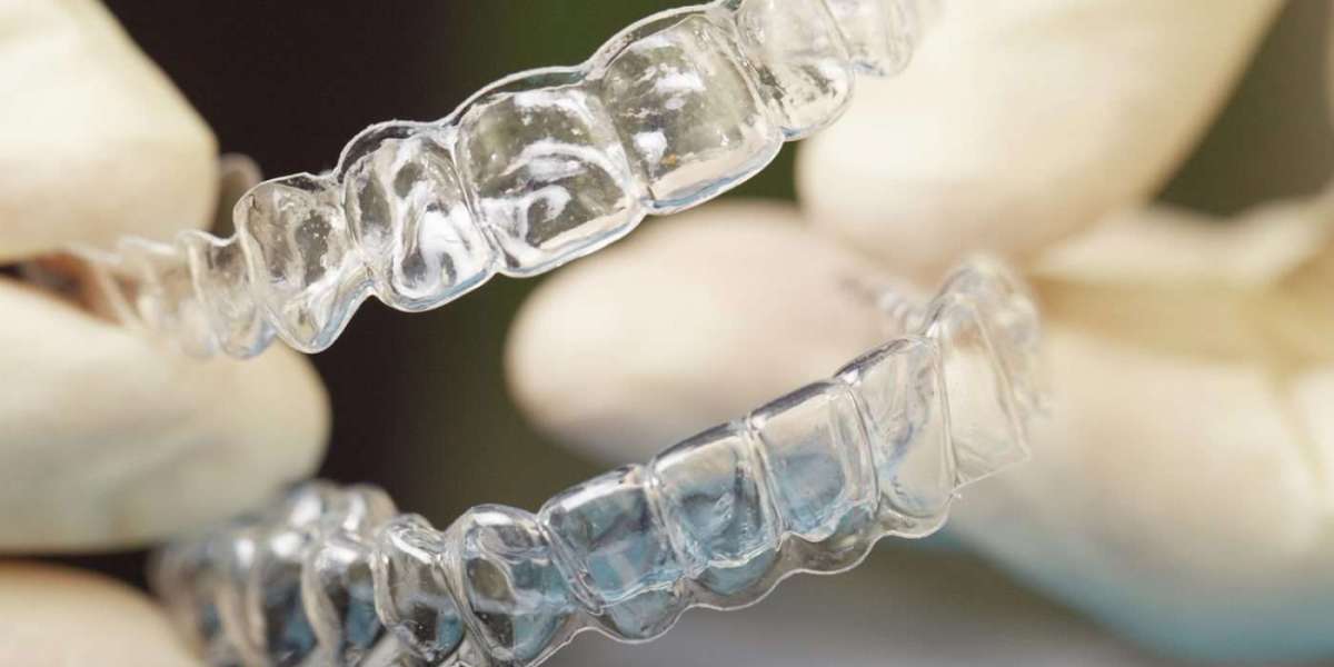 Unlocking Self-Belief: Houston Invisalign Dentist