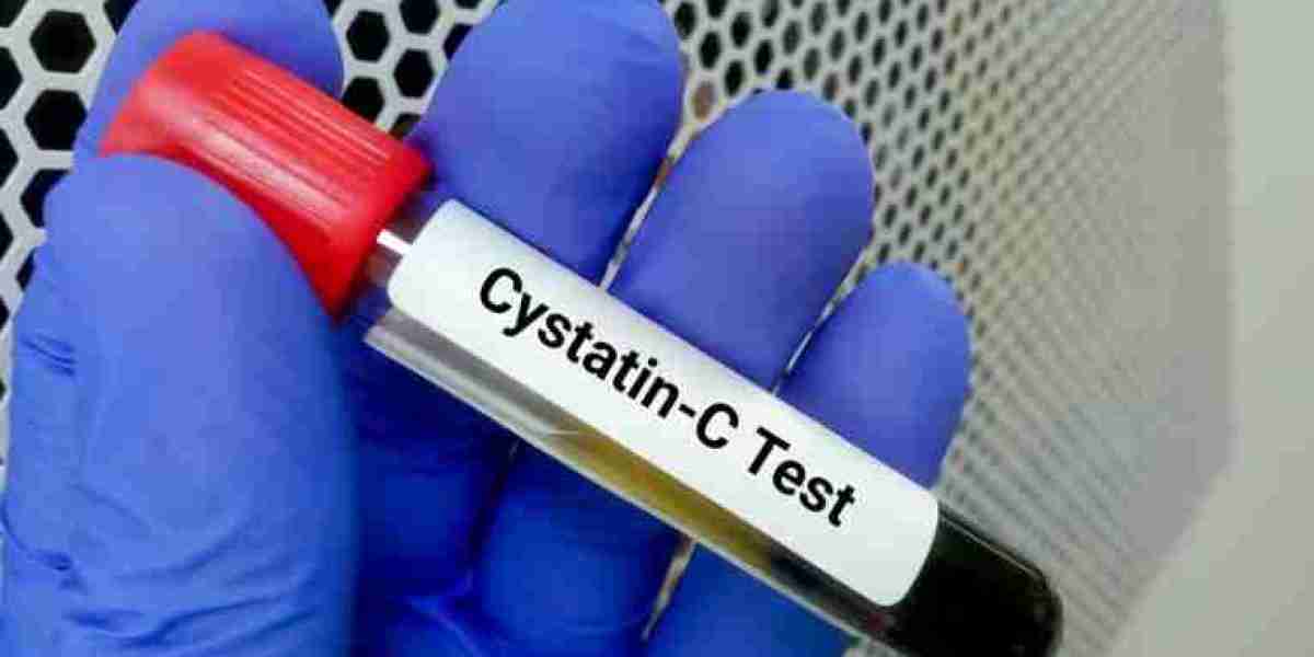 Cystatin C Assay Market Growth Probability, Leading Vendors and Future Scenario During Forecast Period 2024 – 2032
