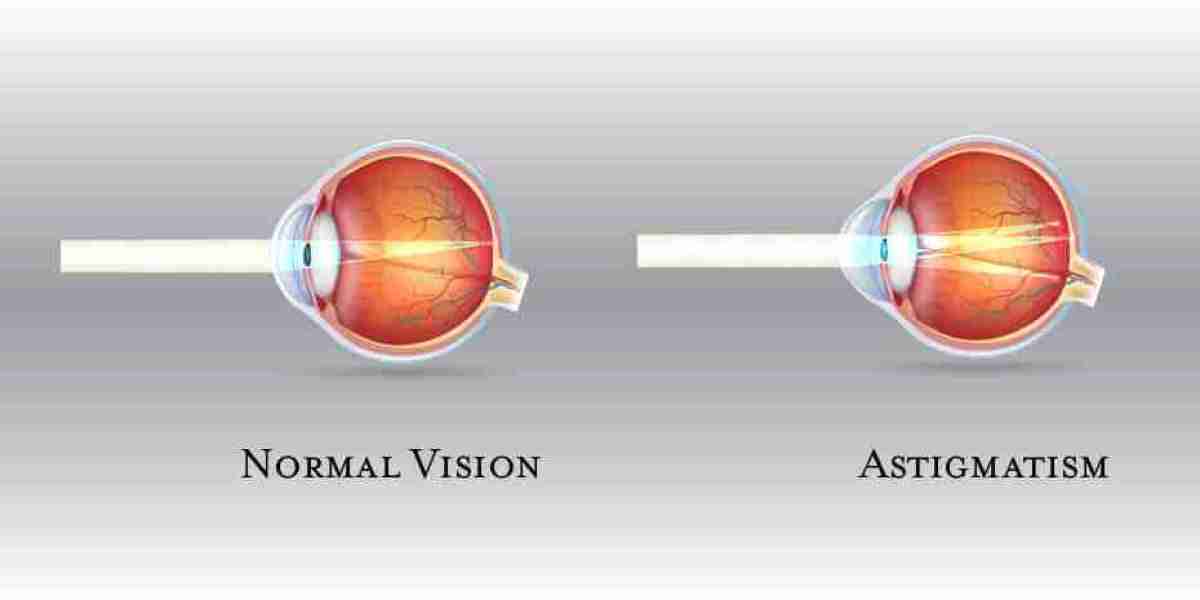 Astigmatism Market Analysis, Epidemiology, Trends and Forecast till 2024-2034