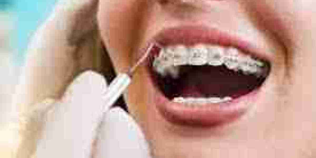 The Cost of Teeth Straightening in Dubai: A Comprehensive Guide