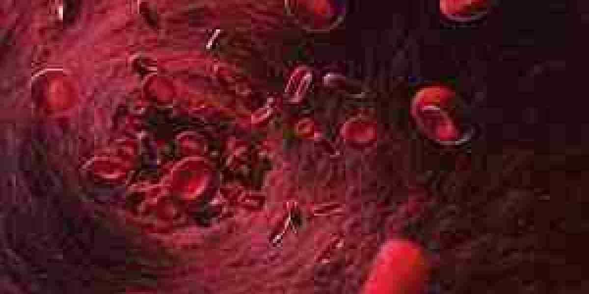 Anemia Market Analysis, Epidemiology, Trends and Forecast till (2024-2034)