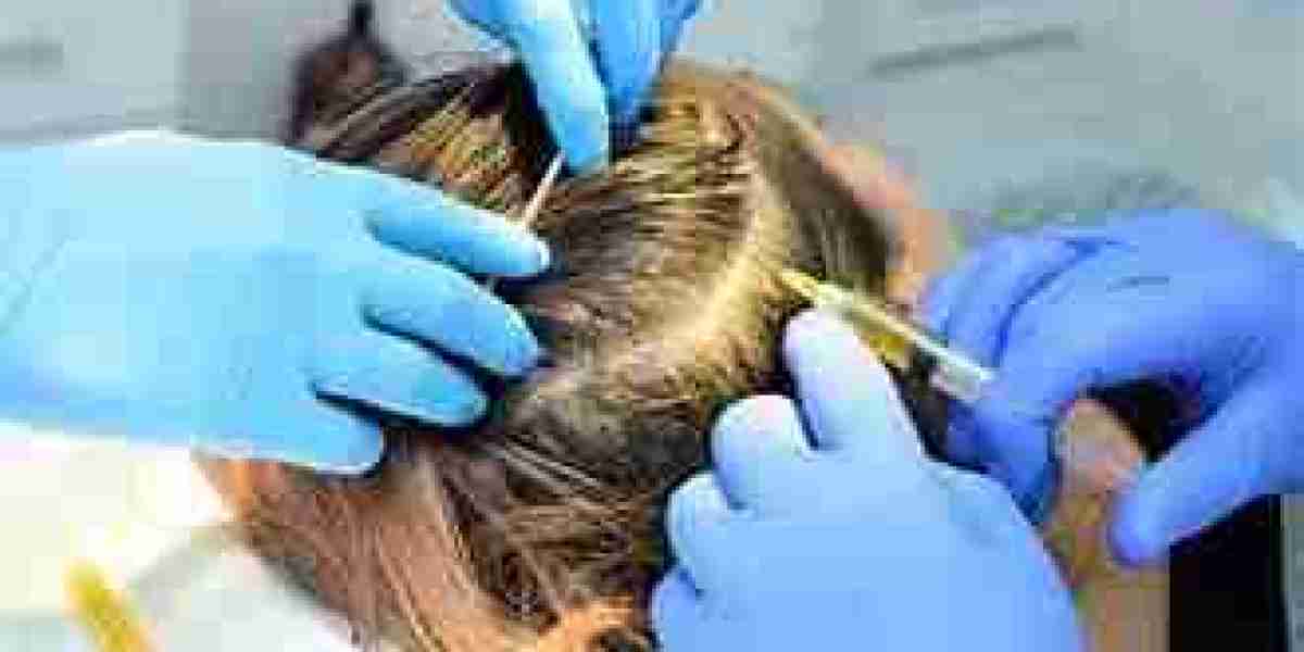Dubai's Fountain of Youth: Rejuvenating Hair Growth with Plasma Injections