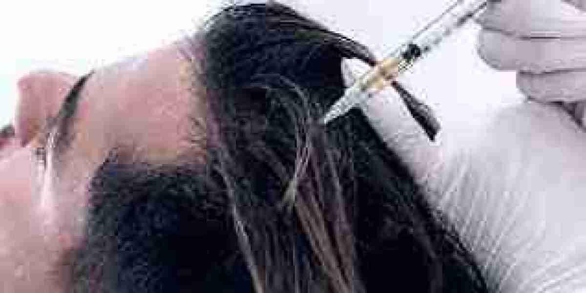 9 Horrible Mistakes to Avoid When You PRP Hair Treatment in Dubai