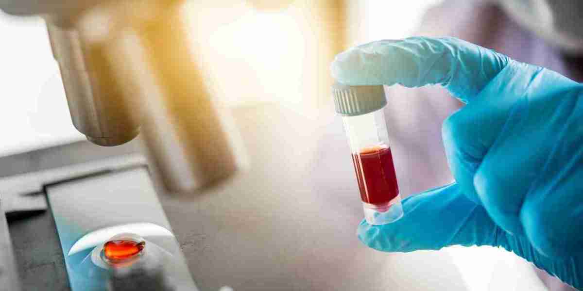 Antibody Testing Market Projected to Show Strong Growth