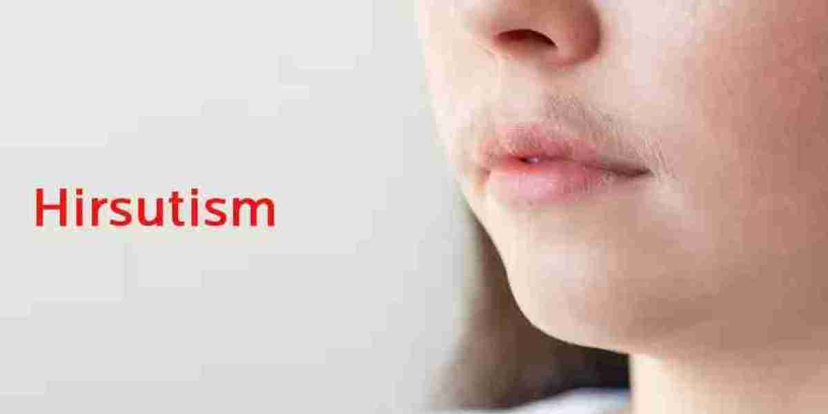 Hirsutism Market Size, In-depth Analysis Report and Global Forecast to 2032