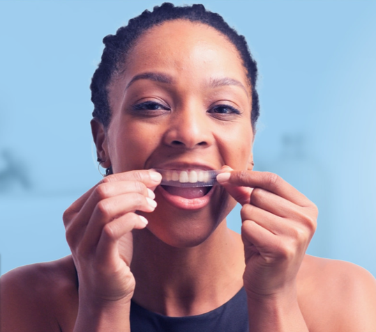 Bidding Farewell to Stains: Crest Tooth Whitening Methods to Combat Teeth Stains - JustPaste.it