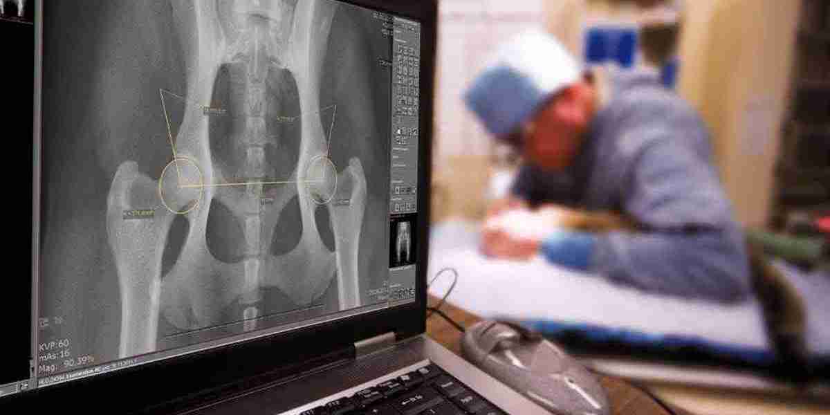 Digital Radiography Market Opportunities, Forecasts 2031