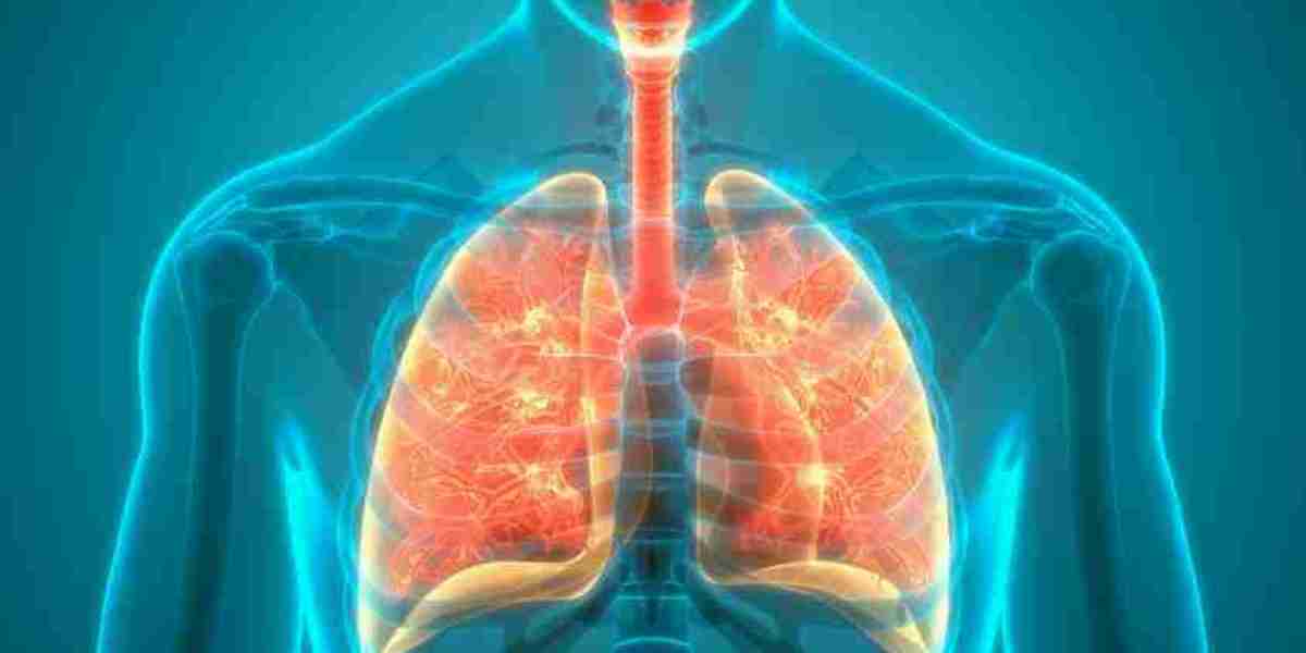 Lung Cancer Therapy Market Trends, Sales, Demand and Analysis by Forecast 2030
