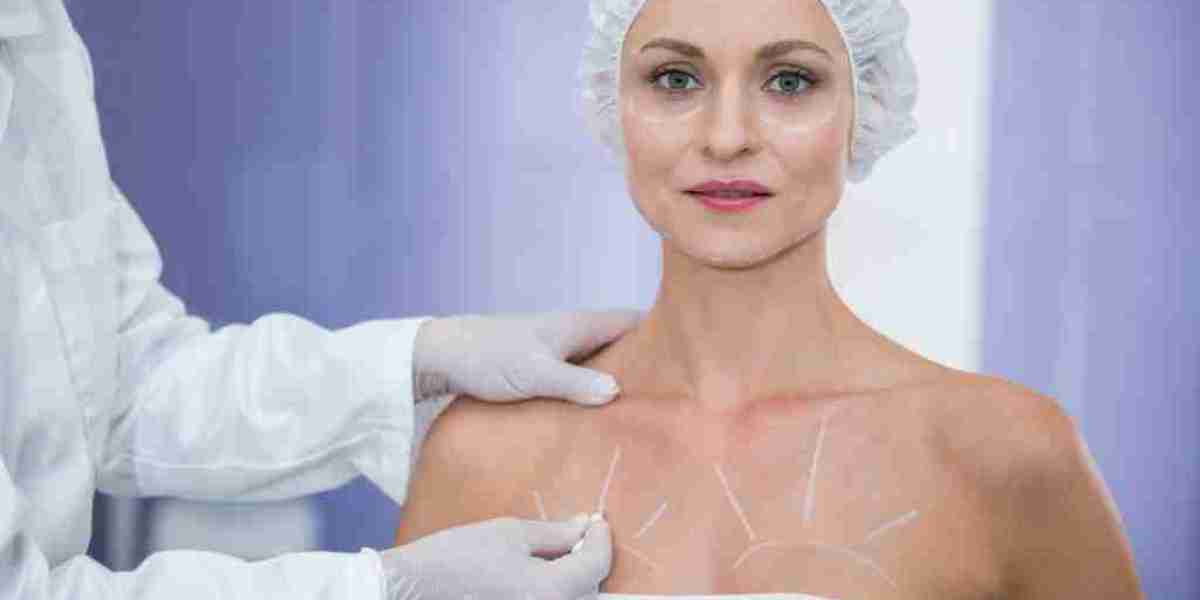 Breast Reconstruction Market Share, Global Industry Analysis Report 2023-2032