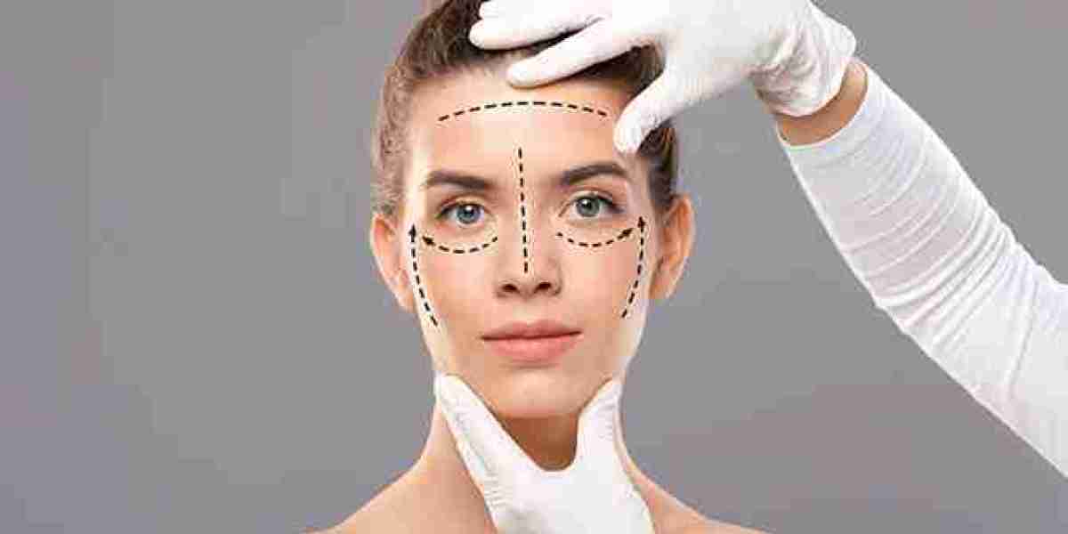 How to Choose the Right Surgeon for Your Facelift Surgery