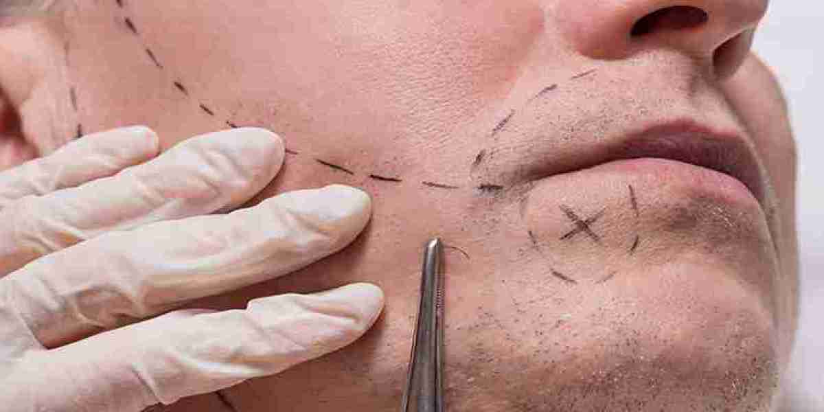 Dubai's Leading Mustache Hair Transplant Experts