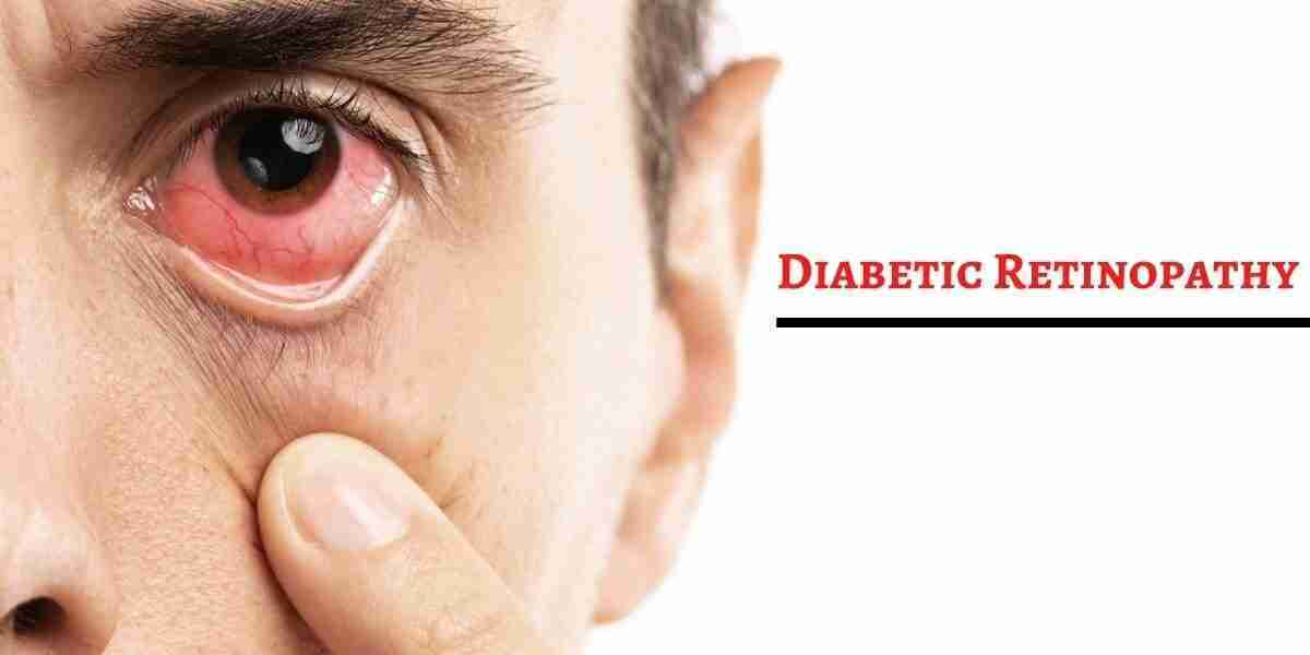 Diabetic Retinopathy Market Size, Share, Growth, Opportunities and Global Forecast to 2032
