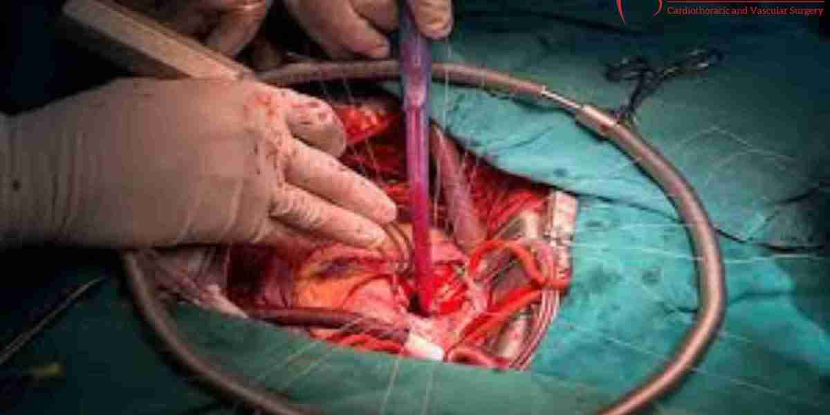 Best Bypass Heart Surgeon In Bhavnagar - Dr. Brajmohan Singh