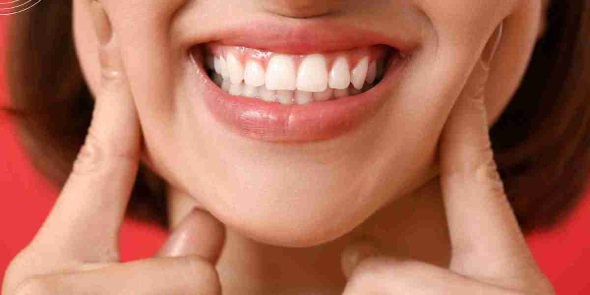 Enhance Your Smile with Gum Contouring Services in Dubai