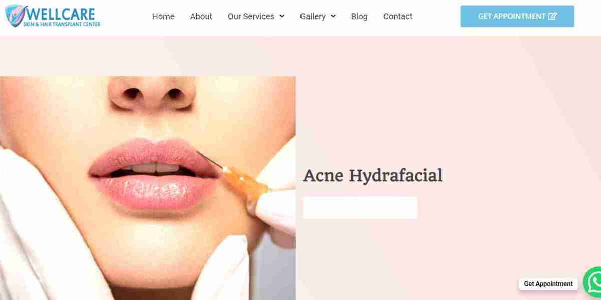 5 Reasons Why HydraFacial is the Go-To Beauty Treatment in Karachi