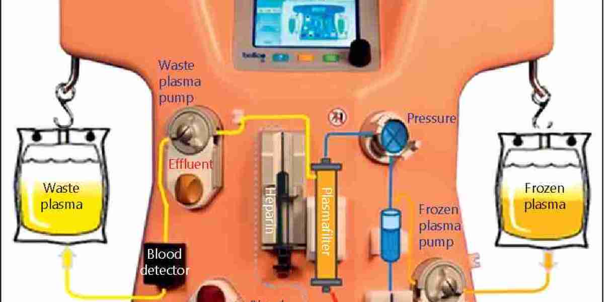 Global Therapeutic Plasma Exchange Market Report, Latest Trends, Industry Opportunity & Forecast to 2032