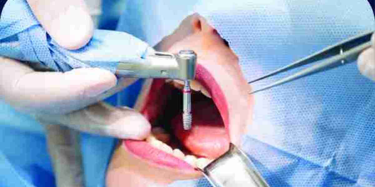 South East Asia Dental Consumables Market - Opportunity Analysis and Industry Forecast (2024-2031)