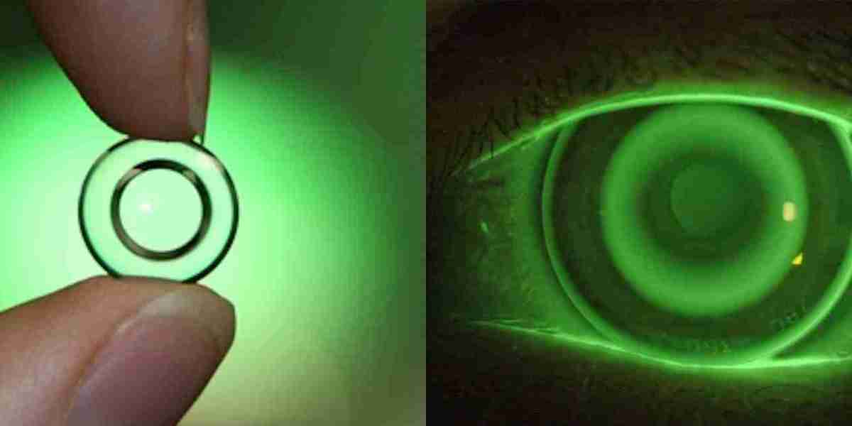 Orthokeratology Lenses Market industry analysis, size, share, growth, trends, and forecast, 2020 - 2028