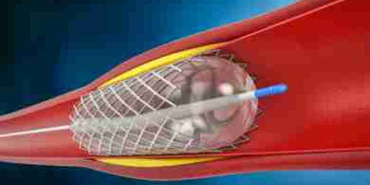 Drug Eluting Balloon Market Size, In-depth Analysis Report and Global Forecast to 2032