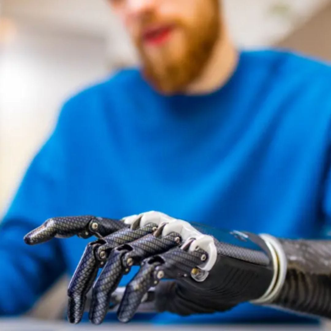 Prosthetic Arms: A Comprehensive Guide to Types, Benefits, and Considerations | by Lifeforcehub pte ltd | Apr, 2024 | Medium