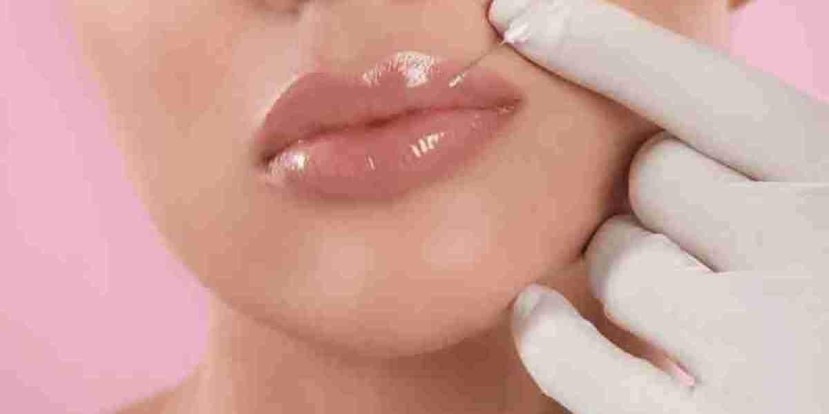 Exploring the Health and Beauty Benefits of Lip Fillers