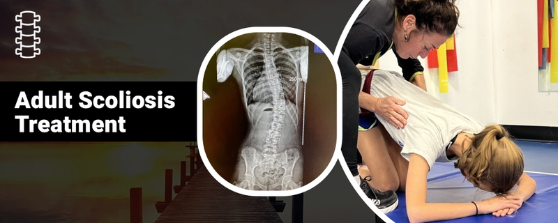 Expert Adult Scoliosis Treatment: Find Specialists Near You