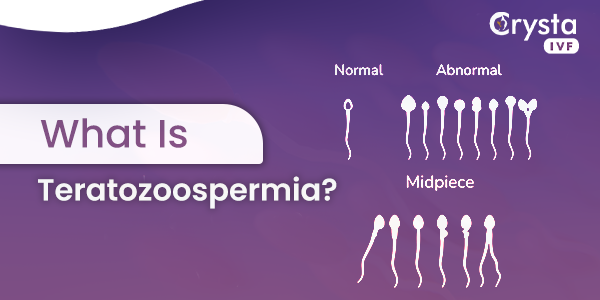 Teratozoospermia: Understanding Abnormal Sperm Morphology | Male Infertility Guide | Medium