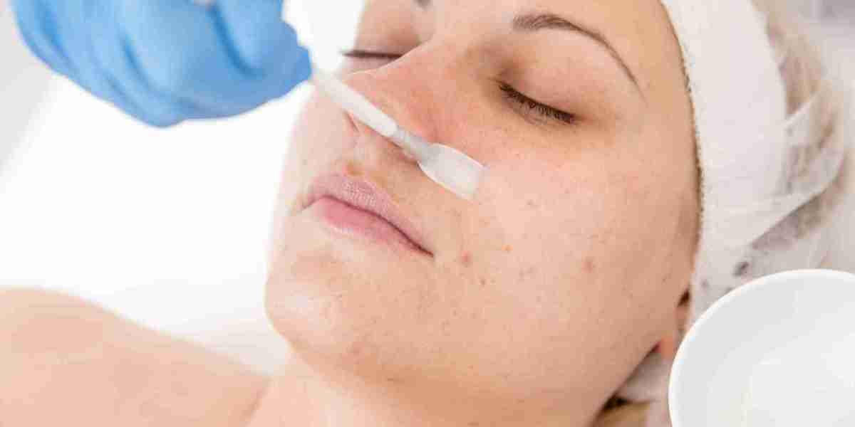 Peel Paradise Riyadh's Exquisite Locations for Chemical Peels
