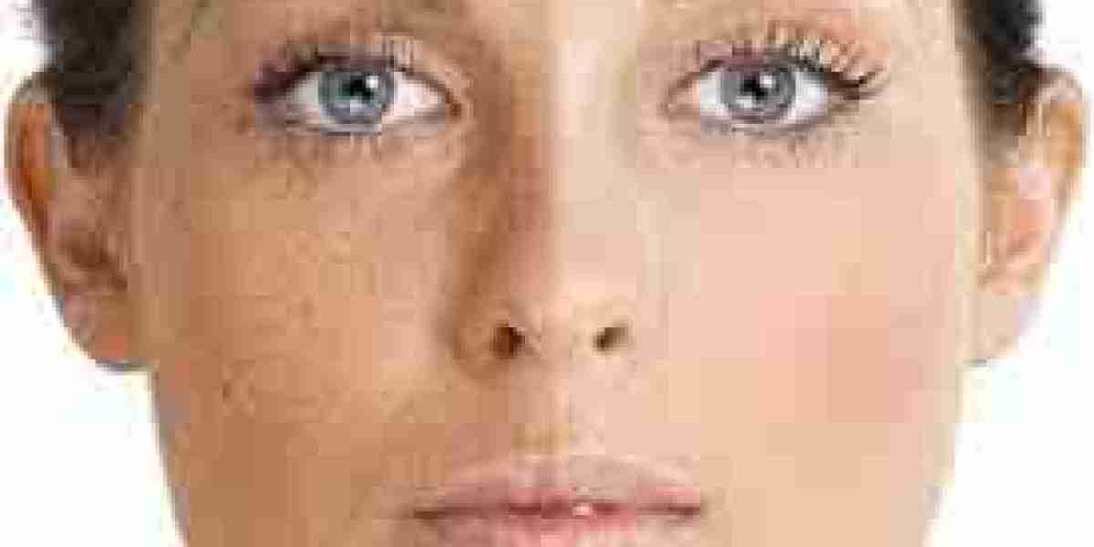 Unlocking Radiance: The Art of Skin Tone Treatment in Dubai