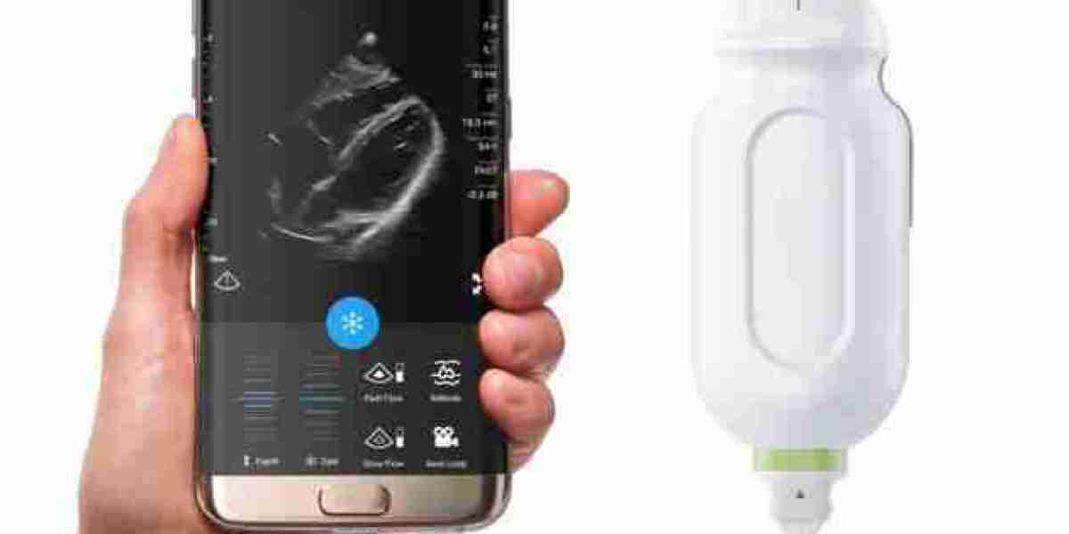 Portable Ultrasound Market to be Worth $3.8 Billion by 2031
