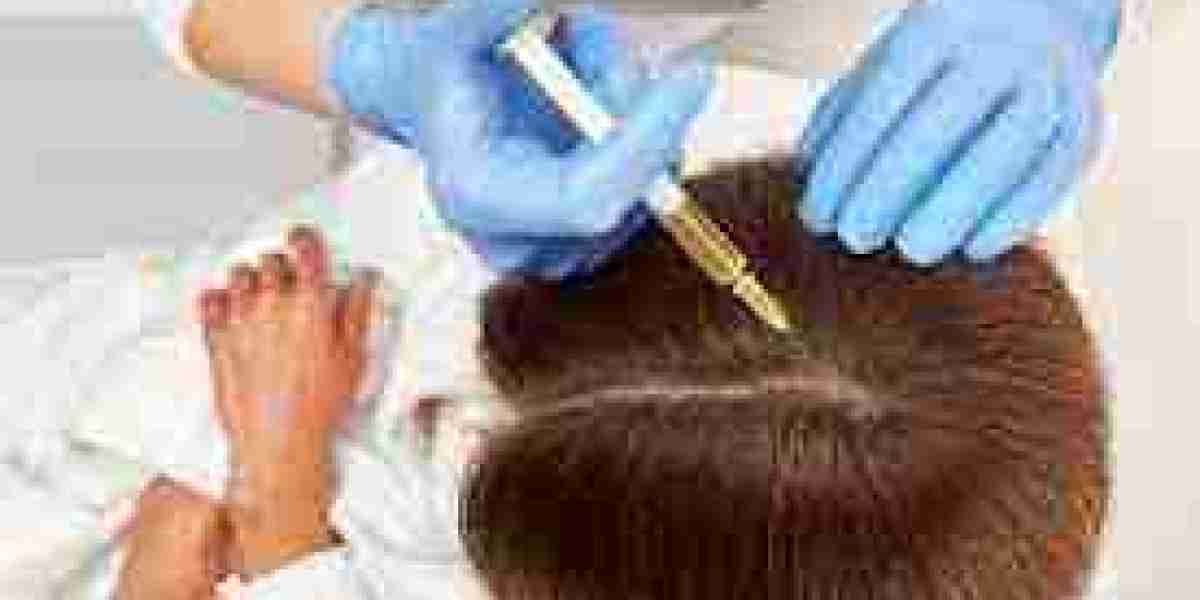 One Dirham Magic: Hair Transplant Bliss in Dubai!