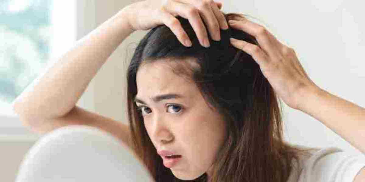 Ultimate Guide to FUE Hair Transplantation in Dubai: Everything You Need to Know