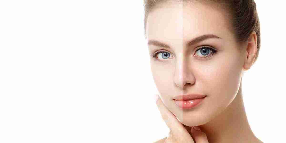 Glutathione Benefits for Skin and role in Skin Brightening