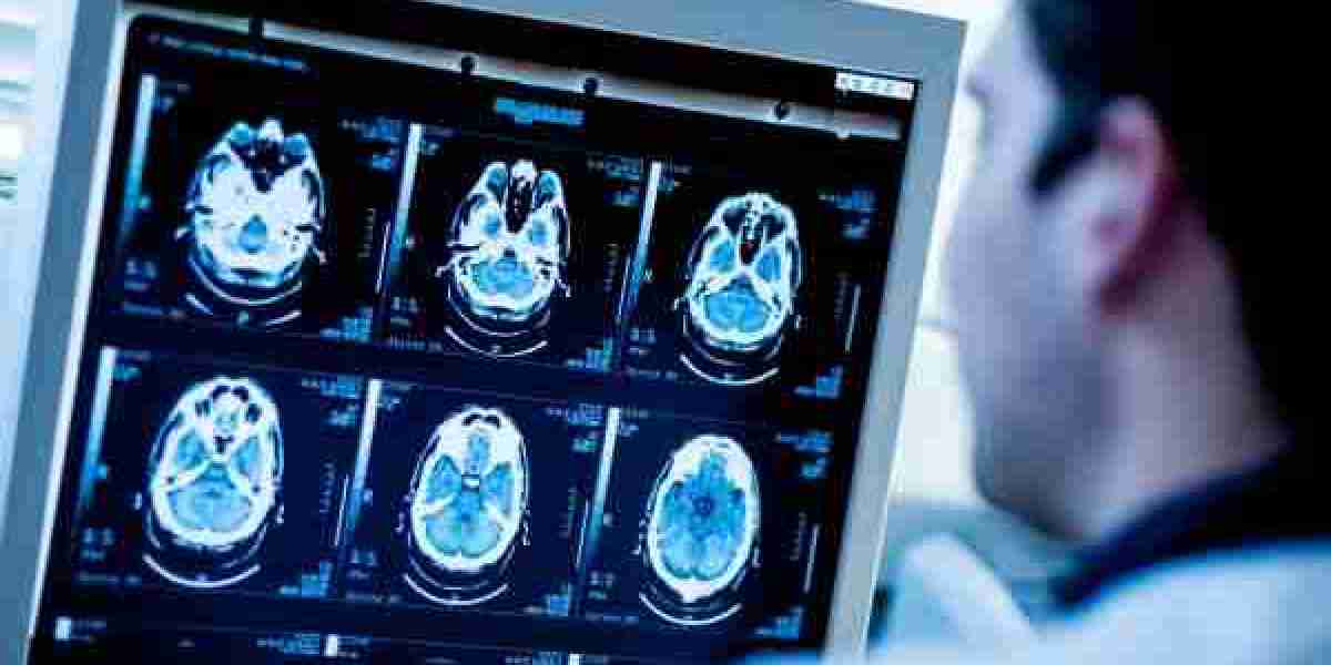 Medical Imaging Market Opportunities, Growth and Forecast by 2028